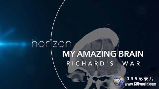 My-Amazing-Brain-Richards-War.jpg