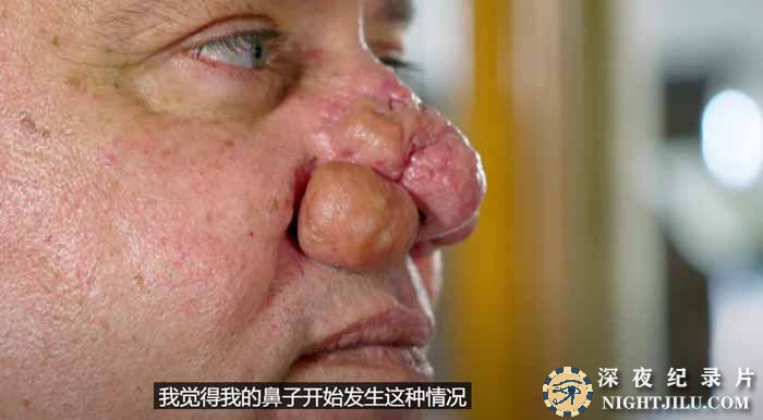 Dr-Pimple-Popper-1.jpg