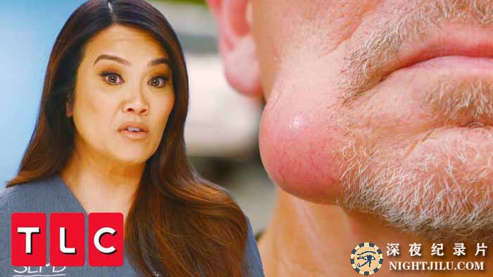 Dr.-Pimple-Popper-S7-8.jpg