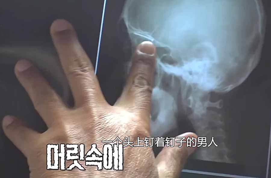 NAO-ZI-DINGZI.jpg