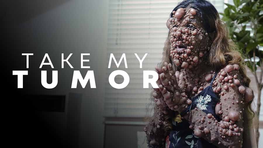 Take-My-Tumor.jpg